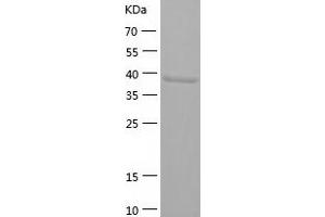 Western Blotting (WB) image for N-Acylsphingosine Amidohydrolase (Acid Ceramidase) 1 (ASAH1) (AA 22-395) protein (His-IF2DI Tag) (ABIN7124089)