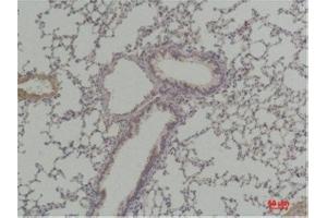 Immunohistochemistry (IHC) analysis of paraffin-embedded Mouse Lung Tissue using Cyclin D1 Rabbit Polyclonal Antibody diluted at 1:200.