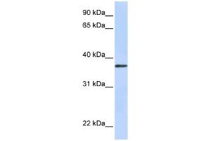 TTMB antibody used at 1 ug/ml to detect target protein. (TMEM200B anticorps  (N-Term))