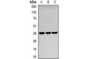 Western blot analysis of SPFH1 expression in HepG2 (A), NIH3T3 (B), Hela (C) whole cell lysates. (ERLIN1 anticorps)