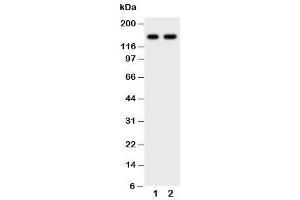 Western blot testing of anti-CD45 antibody and Lane 1:  Jurkat