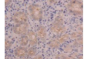 DAB staining on IHC-P; Samples: Human Stomach Tissue (PIGR anticorps  (AA 462-561))