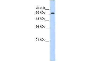 Western Blotting (WB) image for anti-ZIC2 (ZIC2) antibody (ABIN2461223) (ZIC2 anticorps)