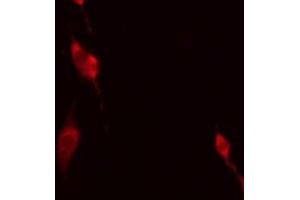 ABIN6275170 staining HeLa by IF/ICC.