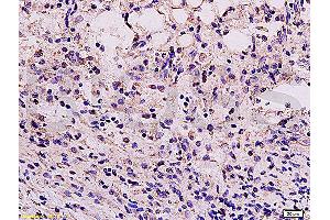 Formalin-fixed and paraffin embedded mouse kidney tissue labeled Anti-Vimentin Polyclonal Antibody, Unconjugated (ABIN672786) at 1:200, followed by conjugation to the secondary antibody and DAB staining