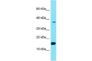 Host: Rabbit Target Name: FER1L6-AS2 Sample Type: Hela Whole cell lysates Antibody Dilution: 1. (FER1L6-AS2 anticorps  (Middle Region))