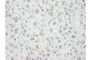 Immunohistochemistry (IHC) image for anti-Minichromosome Maintenance Complex Component 5 (MCM5) (AA 1-50) antibody (ABIN7448655)