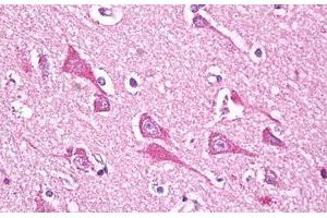 Anti-NDUFS7 antibody IHC staining of human brain, cortex neurons. (NDUFS7 anticorps  (AA 58-68))