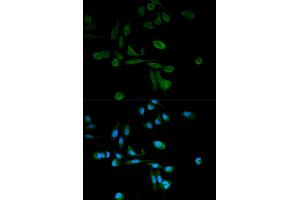 Immunofluorescence analysis of HeLa cells using SIRT7 antibody. (SIRT7 anticorps)
