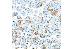Immunohistochemistry of paraffin-embedded Human pancreas using CDX2 antibody  at dilution of 1:300 (40x lens).