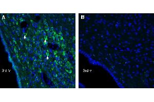 Expression of UCP2 in rat hypothalamus. (Uncoupling Protein 2 (Mitochondrial, Proton Carrier) (UCP2) Peptide)