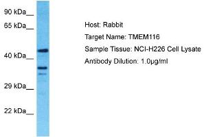 Host: Rabbit Target Name: TMEM116 Sample Tissue: Human NCI-H226 Whole Cell Antibody Dilution: 1ug/ml (TMEM116 anticorps  (C-Term))