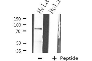 Western blot analysis of IKK-beta expression in HeLa whole cell lysates,The lane on the left is treated with the antigen-specific peptide. (IKBKB anticorps)