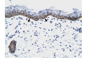 NUDT9 antibody was used for immunohistochemistry at a concentration of 4-8 ug/ml to stain Squamous epithelial cells (arrows) in Human Skin. (NUDT9 anticorps)