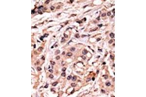 Image no. 1 for anti-Tumor Protein P53 (TP53) (pSer20) antibody (ABIN358188) (p53 anticorps  (pSer20))