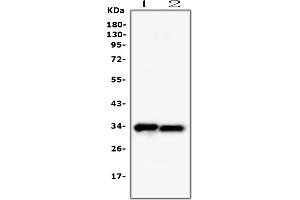 Western blot analysis of PPCS using anti-PPCS antibody (ABIN7602752). (PPCS anticorps  (C-Term))