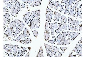 IHC analysis of NCL using anti-NCL antibody (ABIN7600662). (Nucleolin anticorps  (AA 219-629))