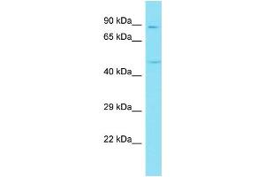 Host: Rabbit Target Name: CCDC13 Sample Type: Fetal Liver lysates Antibody Dilution: 1. (CCDC13 anticorps  (N-Term))