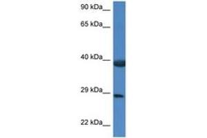 Image no. 1 for anti-HSPA Binding Protein, Cytoplasmic Cochaperone 1 (HSPBP1) (AA 226-275) antibody (ABIN6747386) (HSPBP1 anticorps  (AA 226-275))
