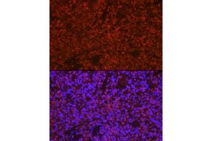 Immunofluorescence analysis of mouse spleen cells using ASC/TMS1 Rabbit pAb (ABIN3021616, ABIN3021617, ABIN3021618, ABIN1513454 and ABIN6215392) at dilution of 1:250 (40x lens).