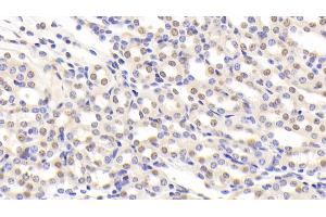 Detection of NCL in Mouse Kidney Tissue using Polyclonal Antibody to Nucleolin (NCL) (Nucleolin anticorps  (AA 353-568))