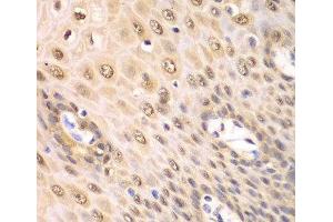 Immunohistochemistry of paraffin-embedded Human esophagus using PSMA2 Polyclonal Antibody at dilution of 1:100 (40x lens). (PSMA2 anticorps)