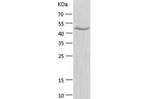 Western Blotting (WB) image for Inositol Hexakisphosphate Kinase 1 (IP6K1) (AA 1-441) protein (His tag) (ABIN7123437) (IP6K1 Protein (AA 1-441) (His tag))