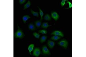Immunofluorescence staining of A549 cells with ABIN7140197 at 1:50, counter-stained with DAPI. (Trichohyalin anticorps  (AA 1922-1941))