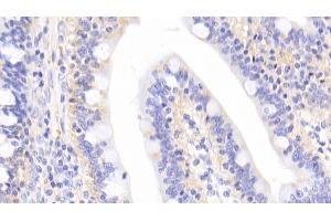 Detection of IRAK4 in Human Small intestine Tissue using Polyclonal Antibody to Interleukin 1 Receptor Associated Kinase 4 (IRAK4)