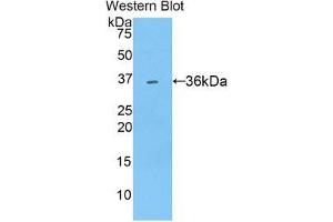 Western blot analysis of the recombinant protein. (SULT1A1 anticorps  (AA 2-295))