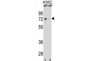 Western blot analysis of ESR1 isoform1 Antibody (C-term) Pab (ABIN1881317 and ABIN2838677) pre-incubated without(lane 1) and with(lane 2) blocking peptide in K562 cell line lysate.