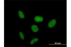 Immunofluorescence of purified MaxPab antibody to ZNF319 on HeLa cell. (ZNF319 anticorps  (AA 1-582))
