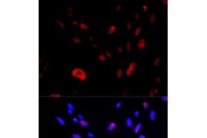 Immunofluorescence analysis of U2OS cells using HUS1 Polyclonal Antibody (HUS1 anticorps)