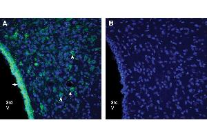 Expression of GPR18 in rat dorsomedial hypothalamus.