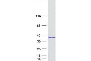 Validation with Western Blot