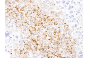 anti-Glutamic-Oxaloacetic Transaminase 2, Mitochondrial (Aspartate Aminotransferase 2) (GOT2) (AA 380-430) antibody