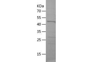 Western Blotting (WB) image for Chromosome 10 Open Reading Frame 137 (C10orf137) (AA 442-652) protein (His-IF2DI Tag) (ABIN7122372)