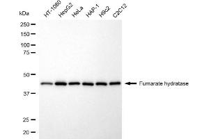 Western blotting analysis using fumarate hydratase antibody (ABIN7798665). (FH anticorps)