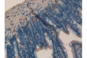 Detection of TFR2 in Mouse Intestine Tissue using Polyclonal Antibody to Transferrin Receptor 2 (TFR2)