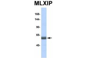 Host:  Rabbit  Target Name:  MLXIP  Sample Type:  Human Fetal Heart  Antibody Dilution:  1.