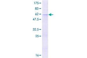 Image no. 1 for ATP-Binding Cassette, Sub-Family A (ABC1), Member 8 (ABCA8) (AA 1-266) protein (GST tag) (ABIN1305433)