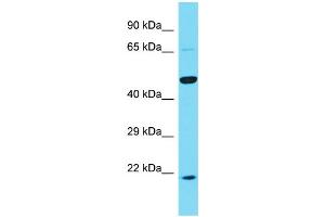 Host: Rabbit Target Name: KRT25 Sample Type: PANC1 Whole Cell lysates Antibody Dilution: 1.