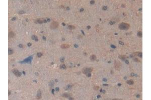 Used in DAB staining on fromalin fixed paraffin- embedded kidney tissue