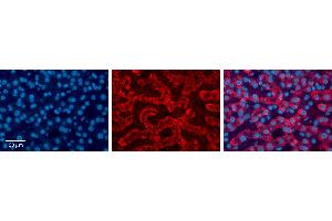 ACAA1 antibody - N-terminal region          Formalin Fixed Paraffin Embedded Tissue:  Human Liver Tissue    Observed Staining:  Cytoplasm in granules of hepatocytes   Primary Antibody Concentration:  1:600    Secondary Antibody:  Donkey anti-Rabbit-Cy3    Secondary Antibody Concentration:  1:200    Magnification:  20X    Exposure Time:  0. (ACAA1 anticorps  (N-Term))