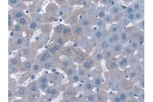 Detection of NQO1 in Mouse Liver Tissue using Polyclonal Antibody to NADH Dehydrogenase, Quinone 1 (NQO1) (NQO1 anticorps  (AA 2-274))
