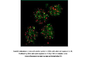 Image no. 3 for anti-Fanconi Anemia, Complementation Group D2 (FANCD2) (N-Term) antibody (ABIN363390)