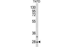 Western blot analysis of SNRPB Antibody (N-term R49) Cat. (SNRPB anticorps  (N-Term))