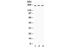 Western blot testing of human 1) SW620, 2) COLO320 and 3) HepG2 cell lysate with LIFR antibody. (LIFR anticorps)