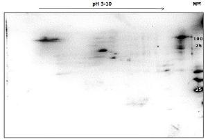 2D SDS-PAGE and WB of PARP1 OVCAR-8 Wild Type Lysate separated on 2D SDS-PAGE and blotted on PVDF to analyze immunocoverage of PARP1 antibody specific for the autocatalytic domain of PARP1.