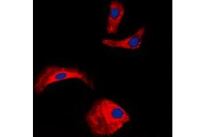 Immunofluorescent analysis of OLFML2A staining in HepG2 cells. (OLFML2A anticorps  (Center))